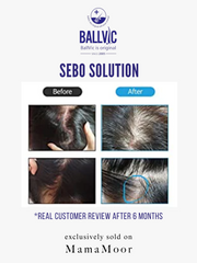 BallVic SEBO Scalp Solution - Topical Dry Scalp Treatment for Men & Women 30g
